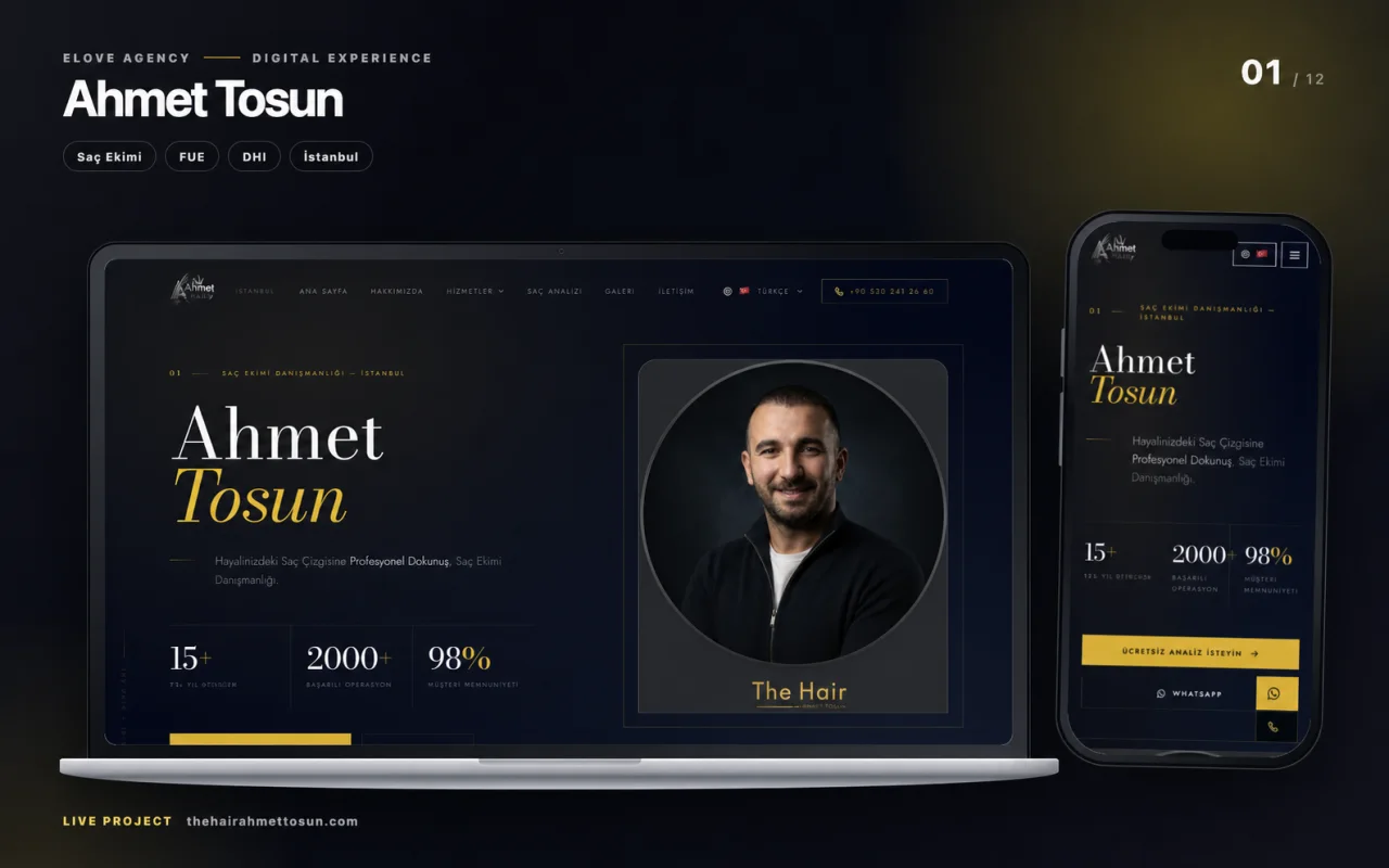 Ahmet Tosun saç ekimi web sitesinin bilgisayar ve telefon görünümü